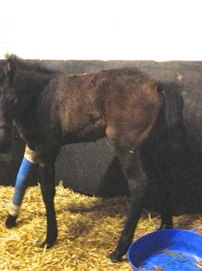 Leg in Fibreglass Plaster